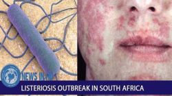 2018 Listeriosis Outbreak in South Africa.