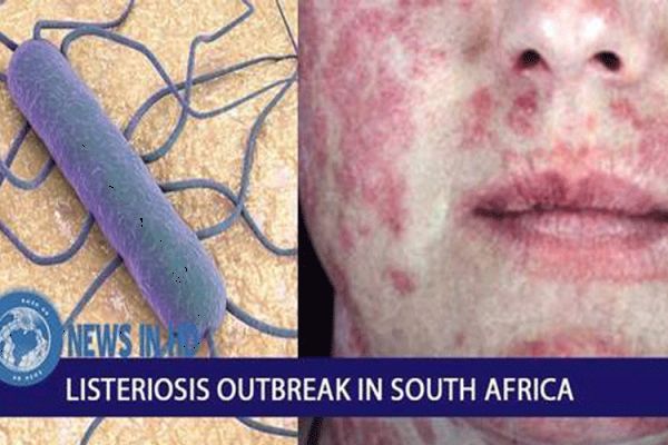 Church Leaders in South Africa Demanding Justice for 2018 Listeriosis Outbreak Victims